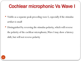Cochlear microphonic Vs Wave I
31
 Visible as a separate peak preceding wave I, especially if the stimulus
artifact is small
 Distinguished by reversing the stimulus polarity, which will reverse
the polarity of the cochlear microphonic;Wave I may show a latency
shift, but will not reverse polarity
 