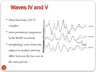 Waves IV and V
43
 often fused into a IV/V
complex
 most prominent component
in the BAEP waveform
 morphology varies from one
subject to another, and may
differ between the two ears in
the same person
 