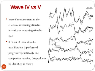 Wave IV vs V
49
 WaveV most resistant to the
effects of decreasing stimulus
intensity or increasing stimulus
rate
 If either of these stimulus
modifications is performed
progressively until only one
component remains, that peak can
be identified as waveV
 