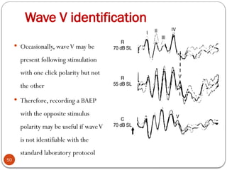 Wave V identification
50
 Occasionally, waveV may be
present following stimulation
with one click polarity but not
the other
 Therefore, recording a BAEP
with the opposite stimulus
polarity may be useful if waveV
is not identifiable with the
standard laboratory protocol
 
