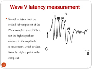 Wave V latency measurement
55
 Should be taken from the
second subcomponent of the
IV/V complex, even if this is
not the highest peak (in
contrast to the amplitude
measurement, which is taken
from the highest point in the
complex)
 