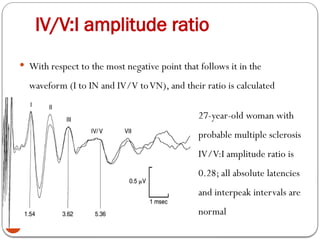 IV/V:I amplitude ratio
57
 With respect to the most negative point that follows it in the
waveform (I to IN and IV/V toVN), and their ratio is calculated
27-year-old woman with
probable multiple sclerosis
IV/V:I amplitude ratio is
0.28; all absolute latencies
and interpeak intervals are
normal
 