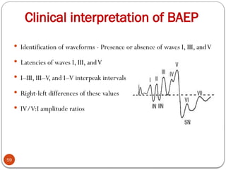 Clinical interpretation of BAEP
59
 Identification of waveforms - Presence or absence of waves I, III, andV
 Latencies of waves I, III, andV
 I–III, III–V, and I–V interpeak intervals
 Right-left differences of these values
 IV/V:I amplitude ratios
 