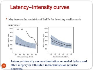 Latency–intensity curves
74
 May increase the sensitivity of BAEPs for detecting small acoustic
neuromas
Latency–intensity curves stimulation recorded before and
after surgery in left-sided intracanalicular acoustic
neuroma
 