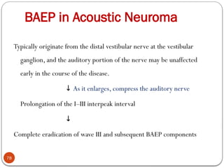 BAEP in Acoustic Neuroma
78
Typically originate from the distal vestibular nerve at the vestibular
ganglion, and the auditory portion of the nerve may be unaffected
early in the course of the disease.
↓ As it enlarges, compress the auditory nerve
Prolongation of the I–III interpeak interval
↓
Complete eradication of wave III and subsequent BAEP components
 
