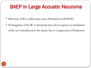 BAEP in Large Acoustic Neuroma
80
 Infarction of the cochlea may cause elimination of all BAEPs
 Prolongation of the III–V interpeak interval in response to stimulation
of the ear contralateral to the tumor due to compression of brainstem
 