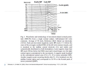 Shibasaki, H., & Hallett, M. (2006). What is the Bereitschaftspotential?. Clinical neurophysiology, 117(11), 2341-2356.
 