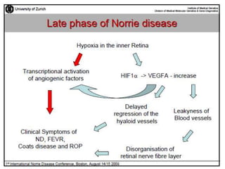 Current Norrie Disease Research