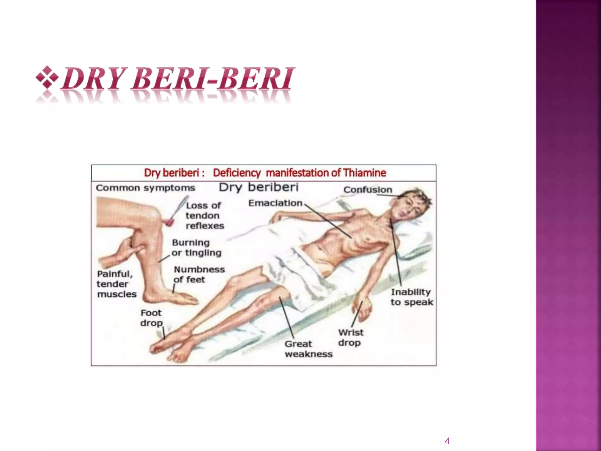 Beri beri | PPT