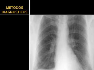 METODOS  DIAGNOSTICOS