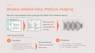 Weakly labeled data: Medical imaging
We don’t have labeled data so we get the labels from medical reports
We extract text
labels via NLP
and use them for
training
How do we do this?
1 Condition 2 Prognosis
Keine Pleuraerguss in der linken Lunge
Keine Erguss in der linken Lunge
Keine Pleuraergusses in der linken Lunge
Keine Randwinkelerguss in der rechte Lunge
Keine Erguß in der Lunge
Word embeddings
help to come up with
smart rules
If “Kein”/”Keine” → NO_EXISTENCE
If “Einige Beweise” → SMALLER_EXISTENCE
Else → DEFINITE_EXISTENCE
 