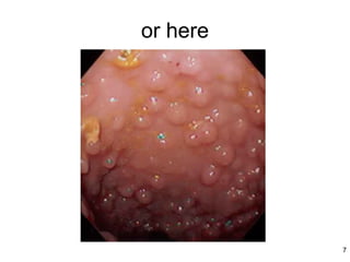 or here




          7
 