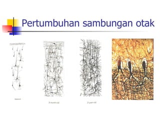 Pertumbuhan sambungan otak 
