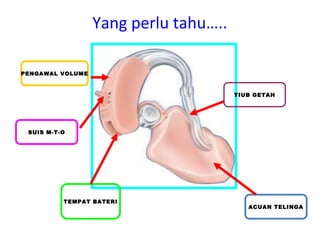 Yang perlu tahu…..
PENGAWAL VOLUME

TIUB GETAH

SUIS M-T-O

TEMPAT BATERI

ACUAN TELINGA

 