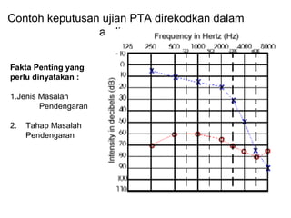 Contoh keputusan ujian PTA direkodkan dalam
audiogram
Fakta Penting yang
perlu dinyatakan :
1.Jenis Masalah
Pendengaran
2.

Tahap Masalah
Pendengaran

 