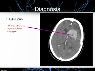 Diagnosis
• CT- Scan
CTscan sho wing a
ruptured Berry
aneurysm.
 