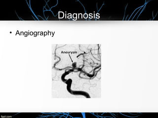 Diagnosis
• Angiography
 