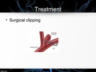 Treatment
• Surgical clipping
 