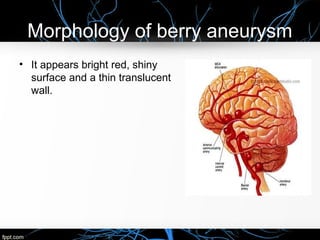 Morphology of berry aneurysm
• It appears bright red, shiny
surface and a thin translucent
wall.
 