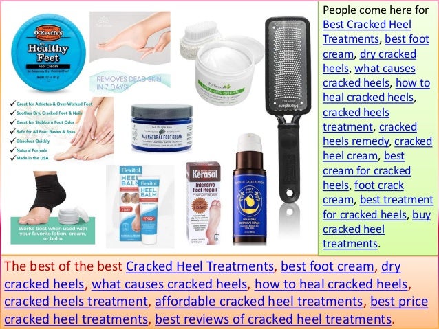 the best treatment for cracked heels