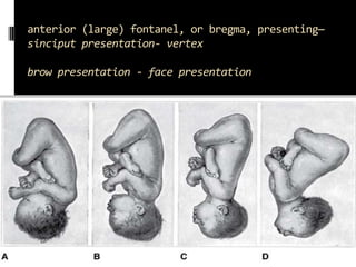 Points!!!

 If presenting by the breech, the fetus often
  changes polarity to make use of the roomier
  fundus for its b...