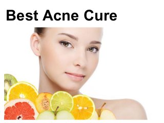 Best Acne Cure
 