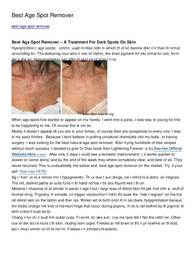Best Age Spot Remover