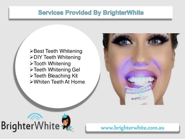 Best At Home Teeth Whitening
