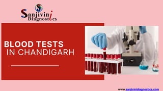 BLOOD TESTS
IN CHANDIGARH
www.sanjivinidiagnostics.com
 