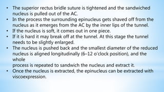 • The superior rectus bridle suture is tightened and the sandwiched
nucleus is pulled out of the AC.
• In the process the surrounding epinucleus gets shaved off from the
nucleus as it emerges from the AC by the inner lips of the tunnel.
• If the nucleus is soft, it comes out in one piece.
• If it is hard it may break off at the tunnel. At this stage the tunnel
needs to be slightly enlarged.
• The nucleus is pushed back and the smallest diameter of the reduced
nucleus is aligned longitudinally (6–12 o’clock position), and the
whole
process is repeated to sandwich the nucleus and extract it.
• Once the nucleus is extracted, the epinucleus can be extracted with
viscoexpression.
 