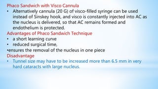 Phaco Sandwich with Visco Cannula
• Alternatively cannula (20 G) of visco-filled syringe can be used
instead of Sinskey hook, and visco is constantly injected into AC as
the nucleus is delivered, so that AC remains formed and
endothelium is protected.
Advantages of Phaco Sandwich Technique
• a short learning curve
• reduced surgical time,
•ensures the removal of the nucleus in one piece
Disadvantage
• Tunnel size may have to be increased more than 6.5 mm in very
hard cataracts with large nucleus.
 