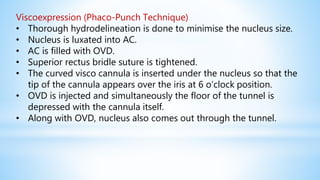 Viscoexpression (Phaco-Punch Technique)
• Thorough hydrodelineation is done to minimise the nucleus size.
• Nucleus is luxated into AC.
• AC is filled with OVD.
• Superior rectus bridle suture is tightened.
• The curved visco cannula is inserted under the nucleus so that the
tip of the cannula appears over the iris at 6 o’clock position.
• OVD is injected and simultaneously the floor of the tunnel is
depressed with the cannula itself.
• Along with OVD, nucleus also comes out through the tunnel.
 