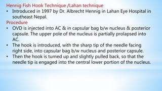 Hennig Fish Hook Technique /Lahan technique
• Introduced in 1997 by Dr. Albrecht Hennig in Lahan Eye Hospital in
southeast Nepal.
Procedure
• OVD is injected into AC & in capsular bag b/w nucleus & posterior
capsule. The upper pole of the nucleus is partially prolapsed into
AC.
• The hook is introduced, with the sharp tip of the needle facing
right side, into capsular bag b/w nucleus and posterior capsule.
• Then the hook is turned up and slightly pulled back, so that the
needle tip is engaged into the central lower portion of the nucleus.
 