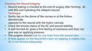 Checking the Wound Integrity
• Wound leaking is checked at the end of surgery after forming AC
with BSS and hydrating the sideport wound.
Technique
• Gently tap on the dome of the cornea or at the limbus
diametrically
opposite to the wound with the hydro-cannula.
• Check the tension status of the AC and wound stability.
• A well-formed AC gives a firm feeling of resistance and does not
give way on applying pressure.
• The surgeon should look for any leaks from the wound sites.
• If folds appear on the Descemet’s layer on tapping, it implies that
AC is not formed adequately
 