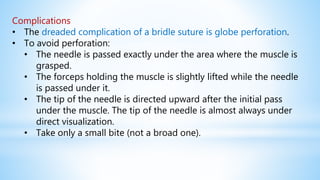 Complications
• The dreaded complication of a bridle suture is globe perforation.
• To avoid perforation:
• The needle is passed exactly under the area where the muscle is
grasped.
• The forceps holding the muscle is slightly lifted while the needle
is passed under it.
• The tip of the needle is directed upward after the initial pass
under the muscle. The tip of the needle is almost always under
direct visualization.
• Take only a small bite (not a broad one).
 