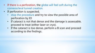 • If there is a perforation, the globe will feel soft during the
corneoscleral tunnel creation.
• If perforation is suspected,
• stop the procedure and try to view the possible area of
perforation by IO
• If cataract is not that dense and the damage is assessable,
proceed to treat (either laser or cryo).
• If the cataract is too dense, perform a B scan and proceed
according to the findings.
 