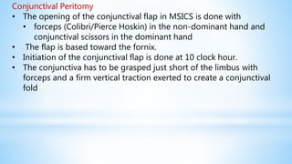 Conjunctival Peritomy
• The opening of the conjunctival flap in MSICS is done with
• forceps (Colibri/Pierce Hoskin) in the non-dominant hand and
conjunctival scissors in the dominant hand
• The flap is based toward the fornix.
• Initiation of the conjunctival flap is done at 10 clock hour.
• The conjunctiva has to be grasped just short of the limbus with
forceps and a firm vertical traction exerted to create a conjunctival
fold
 