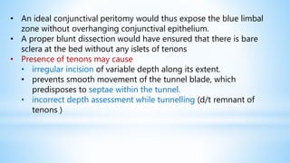 • An ideal conjunctival peritomy would thus expose the blue limbal
zone without overhanging conjunctival epithelium.
• A proper blunt dissection would have ensured that there is bare
sclera at the bed without any islets of tenons
• Presence of tenons may cause
• irregular incision of variable depth along its extent.
• prevents smooth movement of the tunnel blade, which
predisposes to septae within the tunnel.
• incorrect depth assessment while tunnelling (d/t remnant of
tenons )
 