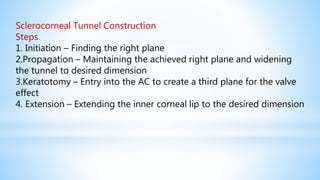 Sclerocorneal Tunnel Construction
Steps
1. Initiation – Finding the right plane
2.Propagation – Maintaining the achieved right plane and widening
the tunnel to desired dimension
3.Keratotomy – Entry into the AC to create a third plane for the valve
effect
4. Extension – Extending the inner corneal lip to the desired dimension
 