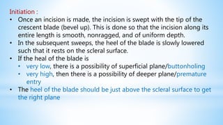 Initiation :
• Once an incision is made, the incision is swept with the tip of the
crescent blade (bevel up). This is done so that the incision along its
entire length is smooth, nonragged, and of uniform depth.
• In the subsequent sweeps, the heel of the blade is slowly lowered
such that it rests on the scleral surface.
• If the heal of the blade is
• very low, there is a possibility of superficial plane/buttonholing
• very high, then there is a possibility of deeper plane/premature
entry
• The heel of the blade should be just above the scleral surface to get
the right plane
 