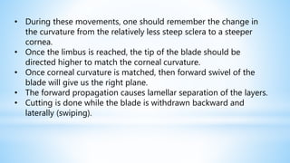 • During these movements, one should remember the change in
the curvature from the relatively less steep sclera to a steeper
cornea.
• Once the limbus is reached, the tip of the blade should be
directed higher to match the corneal curvature.
• Once corneal curvature is matched, then forward swivel of the
blade will give us the right plane.
• The forward propagation causes lamellar separation of the layers.
• Cutting is done while the blade is withdrawn backward and
laterally (swiping).
 