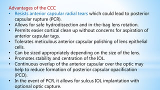 Advantages of the CCC
• Resists anterior capsular radial tears which could lead to posterior
capsular rupture (PCR).
• Allows for safe hydrodissection and in-the-bag lens rotation.
• Permits easier cortical clean up without concerns for aspiration of
anterior capsular tags.
• Tolerates meticulous anterior capsular polishing of lens epithelial
cells.
• Can be sized appropriately depending on the size of the lens.
• Promotes stability and centration of the IOL.
• Continuous overlap of the anterior capsular over the optic may
help to reduce formation of posterior capsular opacification
(PCO).
• In the event of PCR, it allows for sulcus IOL implantation with
optional optic capture.
 