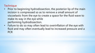 Technique
• Prior to beginning hydrodissection, the posterior lip of the main
incision is compressed so as to remove a small amount of
viscoelastic from the eye to create a space for the fluid wave to
make its way in the eye while
performing hydrodissection.
• Failure to do so may often lead to overinflation of the eye with
fluid and may often eventually lead to increased pressure and a
PCR
 