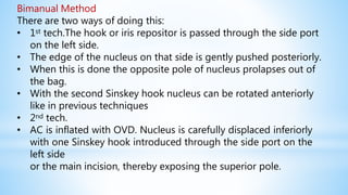 Bimanual Method
There are two ways of doing this:
• 1st tech.The hook or iris repositor is passed through the side port
on the left side.
• The edge of the nucleus on that side is gently pushed posteriorly.
• When this is done the opposite pole of nucleus prolapses out of
the bag.
• With the second Sinskey hook nucleus can be rotated anteriorly
like in previous techniques
• 2nd tech.
• AC is inflated with OVD. Nucleus is carefully displaced inferiorly
with one Sinskey hook introduced through the side port on the
left side
or the main incision, thereby exposing the superior pole.
 