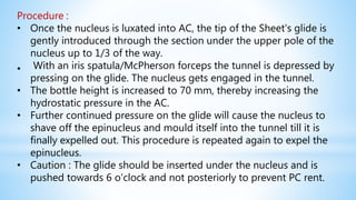 Procedure :
• Once the nucleus is luxated into AC, the tip of the Sheet’s glide is
gently introduced through the section under the upper pole of the
nucleus up to 1/3 of the way.
• With an iris spatula/McPherson forceps the tunnel is depressed by
pressing on the glide. The nucleus gets engaged in the tunnel.
• The bottle height is increased to 70 mm, thereby increasing the
hydrostatic pressure in the AC.
• Further continued pressure on the glide will cause the nucleus to
shave off the epinucleus and mould itself into the tunnel till it is
finally expelled out. This procedure is repeated again to expel the
epinucleus.
• Caution : The glide should be inserted under the nucleus and is
pushed towards 6 o’clock and not posteriorly to prevent PC rent.
 
