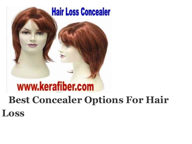 Best option for hair loss