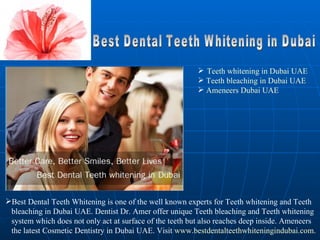Best Dental Teeth Whitening in Dubai ,[object Object],[object Object],[object Object],[object Object],[object Object],[object Object],[object Object]