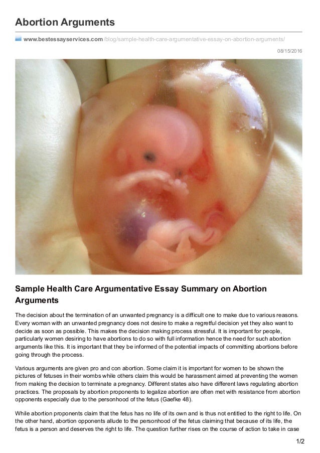 Argumentative Essay against Abortion, with Outline - blogger.com arguments for and against abortion essay