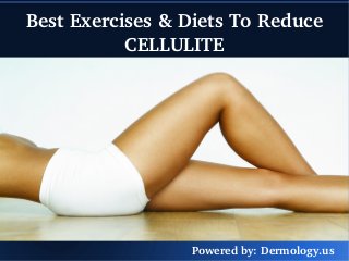 Best Exercises & Diets To Reduce 
CELLULITE 
Powered by: Dermology.us 
 