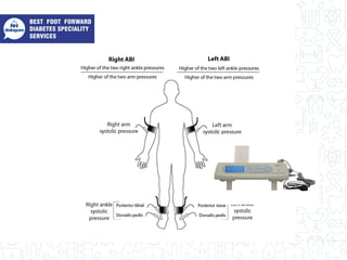 Adapted from: Norman PE, Eikelboom JW, Hankey GJ. Peripheral arterial disease: prognostic significance and
prevention of atherothrombotic complications. Medical Journal of Australia 2004; 181:150-154. Figure 1, p.151
 